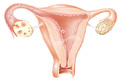 Ovary